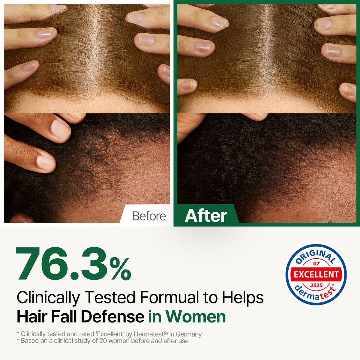 ROOTON Alpha Erguen Hair Tonic 5.07 fl.oz (150ml) – Women Vegan Formula for Anti Hair Loss