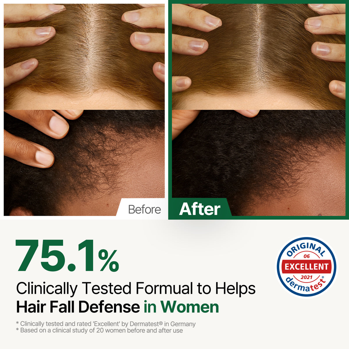 ROOTON Alpha Erguen Shampoo 16.9 fl.oz (500ml) – Women Vegan Formula for Anti Hair Loss