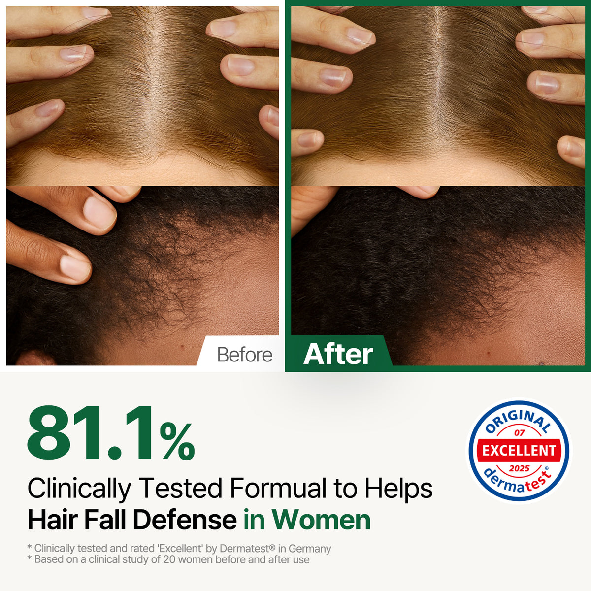 ROOTON Alpha Erguen™ Treatment 16.9 fl.oz (500ml) – Women Vegan Formula for Hair Cortex Repair